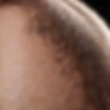 Understanding Hair Growth Patterns to Prevent Ingrown Hairs Illustration of hair growth patterns and ingrown hairs