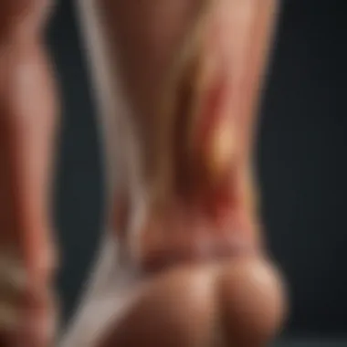 Anatomy diagram highlighting the Achilles tendon and surrounding muscles