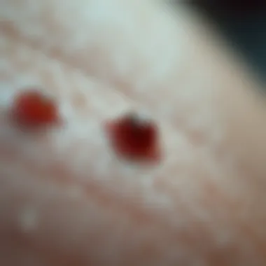 Understanding Ingrown Hairs Close-up view of ingrown hairs on skin