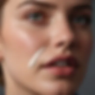 Application of Antiviral Cream A close-up of antiviral cream being applied to a cold sore