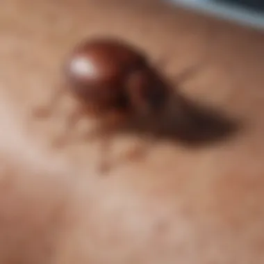 A close-up view of a tick embedded in skin